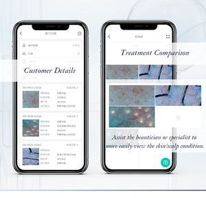 MEIBOYI 무선 피부 분석기 와이파이 연결 휴대용 두피 분석기 모낭 감지기 가정용 미용 장비 - Product Image 4