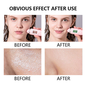 Limpiador de Espuma facial de aceite de argán, reparación hidratante con vitamina E, ácido hialurónico, <span class=keywords><strong>argana</strong></span> suave para pieles sensibles, PH equilibrado - Product Image 6