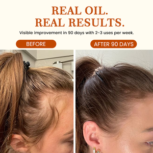 Haargroei Behandeling Olie Hoofdhuid Verzorging Rozemarijn Hydraterende Versterking Vermindert Uitval Voedt Follikels Dikker Haar - Product Image 5