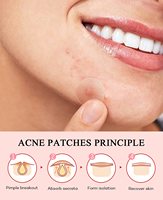 Patchs Hydrocolloïdes Anti-Acné Effet Immédiat pour Boutons et Points Noirs – Personnalisation Possible – Offre Spéciale Usine