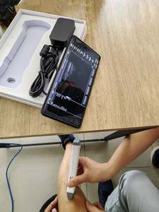 Sonde à ultrasons Doppler linéaire convexe 2 en 1 sans fil Wifi Machine à ultrasons sans fil couleur portable - Product Image 3