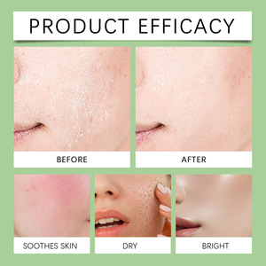 Sérum apaisant hydratant et raffermissant pour l'élimination des points noirs, produit de soin de la peau naturel de 30ml - Product Image 3