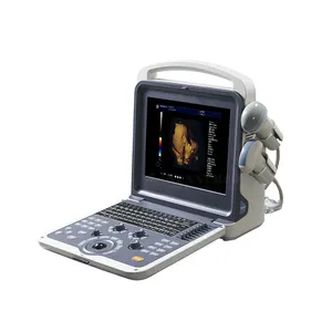Satılık SY-A042N tıbbi teşhis 4D renkli Doppler ultrason tarayıcı ekokardiyografi