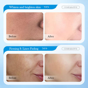 ซาโดเออร์ 8 ดี ไฮยาลูโรนิค แอซิด แอนตี้ริงเคิล นูริชชิ่ง ไฮเดรติ้ง มาส์ก ไฮเดรติ้ง มอยส์เจอร์ไรซิ่ง มาส์ก - Product Image 3