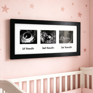 Cadre personnalisable en bois pour <span class=keywords><strong>collage</strong></span> d'échographie de maternité, cadre d'affichage de <span class=keywords><strong>photos</strong></span> d'échographie de bébé pour les 3 trimestres, décoration souvenir de baby shower - Product Image 1