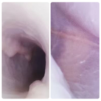 Modèle d'entraînement ES001-S1 Taille Adulte pour la pratique de l'endoscopie gastro-intestinale, des voies biliaires, des voies pancréatiques, de la vésicule biliaire