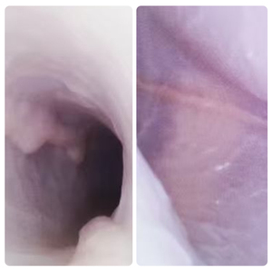 Modello di Addestramento ES001-S1 per Endoscopia del Tratto Gastrointestinale, Canale Biliare, Canale Pancreatico e Vescica Epatica, Taglia Adulto - Product Image 4