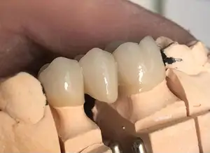 Yucera 3D Pro Multilayer Open System Pre-shaded Dental Zirconia Blocks CADCAM Dental Ceramic Block For Lab