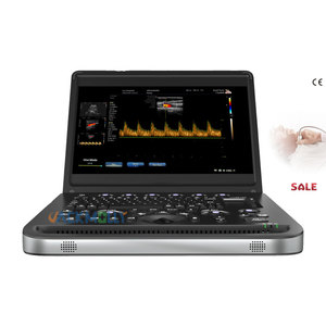 Escáner de imágenes médicas de pantalla grande con dispositivo <span class=keywords><strong>USG</strong></span> Doppler a color de 15,6 pulgadas con visualización clara para uso clínico - Product Image 1