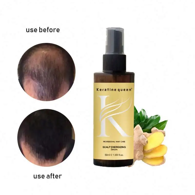 private label care Ginger Make growth anti Hair Loss oil Treatment for man