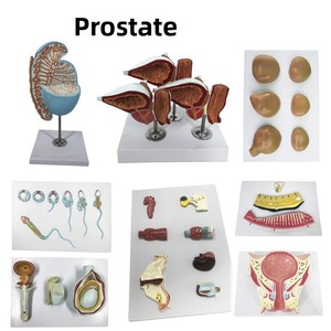 Modelo Anatómico de Riñón con Glándulas Adrenales Ampliadas, Riñones Patológicos, Anatomía Visceral Humana, Material PVC, MAXCARE MAC-L27 - Product Image 3