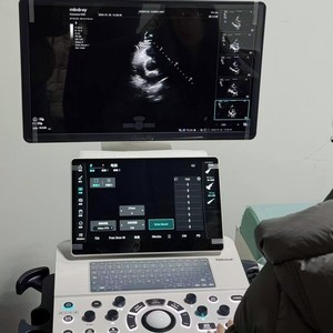 Ecógrafo Doppler Color Mindray Consona N5 para Diagnóstico, Máquina de Ultrasonido para Cardiología, Abdomen y Vascular - Product Image 3