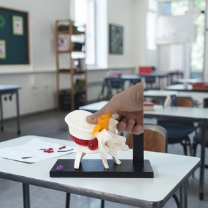 Modèle d'anatomie de la colonne vertébrale humaine avec hernie discale, en PVC écologique, pour la formation en écoles de médecine - Product Image 2