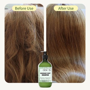 Shampooing à l'huile <span class=keywords><strong>de</strong></span> romarin et à la menthe pour réduire la <span class=keywords><strong>chute</strong></span> des <span class=keywords><strong>cheveux</strong></span> <span class=keywords><strong>Produit</strong></span> pour homme et <span class=keywords><strong>femme</strong></span> Vente en gros Bio 480ml - Product Image 3