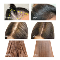 Spray liquide nourrissant à la caféine pour cheveux, traitement de croissance des cheveux, sérum essence, réparation, soin, tonique liquide pour cuir chevelu à la phyto-caféine pour cheveux fins