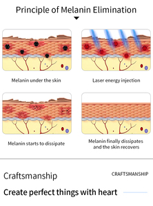 Dispositivo Portátil de Eliminación de Manchas con Tecnología de Picosegundos para Uso Doméstico, Eliminación de Tatuajes y Lavado de Cejas sin Dolor, Rejuvenecimiento de la Piel - Product Image 4