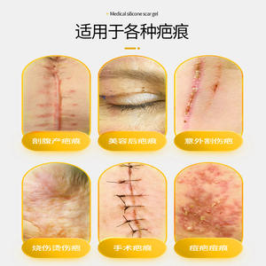 Gel cicatrisant médical en silicone Sunflower 20g pour les cicatrices de brûlure, chirurgicales et hypertrophiques, dispositif médical de classe II - Product Image 4