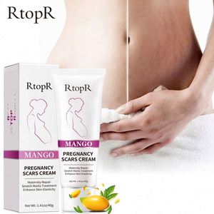 RTOPR Crema Naturale al Mango per Rimuovere le Smagliature, Crema per la Rimozione delle Smagliature - Product Image 5