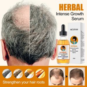 Sérum Anti-Chute et Huile de Croissance pour Cheveux sous Marque Privée Produits de Traitement contre l'Alopécie et la Perte de Cheveux Huile de Repousse aux Herbes Biologiques - Product Image 2