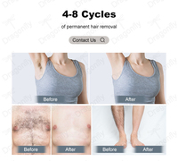 Épilateur laser à diode compact pour la maison, sûr et facile à utiliser, qualité équivalente à celle des salons, indolore et efficace, tous types de peau, CE