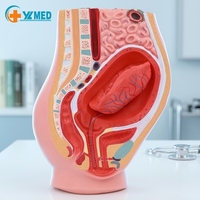 Modèle de décapage du placenta, système reproductif féminin, utérus, ovaires, anatomie pelvienne, obstétrique et gynécologie, enseignement médical