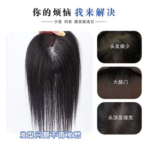 Protesi Capillare <span class=keywords><strong>Donna</strong></span> Senza Cuciture per Coprire i <span class=keywords><strong>Capelli</strong></span> Bianchi, Aumentare il Volume e Creare un Effetto Naturale e Invisibile - Product Image 5
