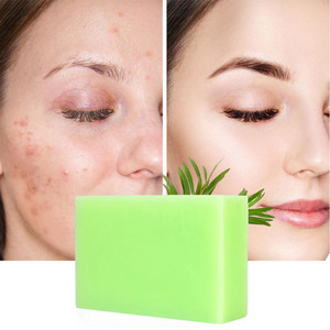 Jabón Artesanal Anti-Imperfecciones con Aceite de Árbol de Té 100g, Jabón Sólido para Combatir el Acné, Blanqueador, para Uso Corporal y Facial, Refrescante y Limpiador - Product Image 1