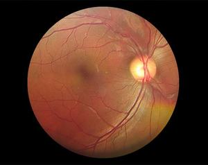 Dispositivo de retinografía de mano, cámara de fondo de retina de mano, portátil, 2 uds. - Product Image 2