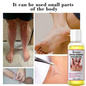 Minyak pengelupas ekstra kuat perawatan kulit wajah pemutih Stretch Patch tanda bekas luka Serum perbaikan penghilang noda hitam produk kecantikan - Product Image 3