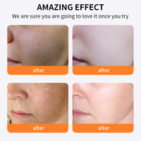 Vente en gros de crème hydratante et nourrissante pour le soin de la peau du visage, 50 g, réparation, vitamine C, blanchiment
