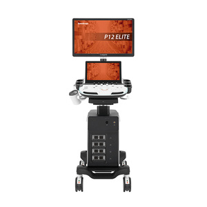 Sistema de Diagnóstico por Ultrasonido Doppler Digital de Alta Calidad Sonoscape P12 Elite con Imagen I+Scan para Humanos/Hospitales/Clínicas - Product Image 3