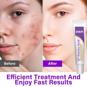Crème Visage à l'Acide Azélaïque, Ascorbate de Tetrahexyldecyl, Hyaluronate de Sodium, Niacinamide – Hydratante, Réparatrice, Unifiante et Décongestionnante - Product Image 4
