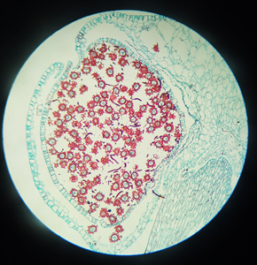 Gelsonlab HSSL-022 Vetrini Preparati per Biologia Modello Anatomico di Ibisco L.<span class=keywords><strong>S</strong></span>. STEM per l'educazione alla scienza medica nelle scuole - Product Image 4