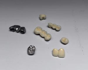 Stampante <span class=keywords><strong>3D</strong></span> in metallo per protesi dentali in lega di cobalto-cromo - Stampante <span class=keywords><strong>3D</strong></span> ZRapid DMLS DEN160 - Product Image 6