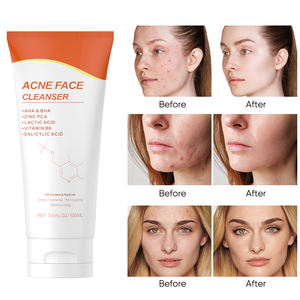 Acne detergente viso detergente idratante pulizia profonda olio di controllo esfoliante per la pelle del viso cura della pelle 100ml MOOYAM lavaggio del viso - Product Image 3