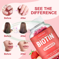 OEM Haar Groei Olie Biotine Collageen Keratine Gummies Vitamine Supplementen Groothandel Gummy Candy voor Vrouwen Niet voor Zwangere Vrouwen