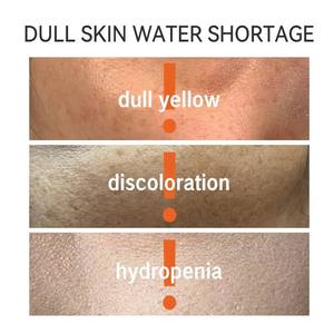 Sérum hydratant pour le visage à la vitamine C GREENLEM 30 ml, formule éclaircissante et hydratante en profondeur pour tous les types de peau, marque privée - Product Image 5