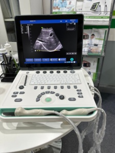 Appareil d'échographie portable noir et blanc DMU73 avec écran de 15 pouces pour le diagnostic clinique humain et vétérinaire - Product Image 5