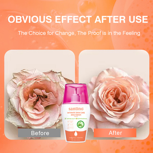 OEM ODM Marque Privée Santino Soins Intimes de la Peau Nettoyant Quotidien à l'Aloe Vera avec Extrait de Calendula pour l'Hydratation et le Nettoyage - Product Image 3
