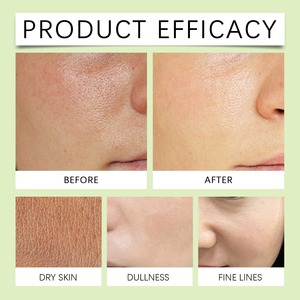 Limpiador Facial Equilibrado de pH con Frijol Mungo OEM, 80 g, Limpieza Profunda, Control de Grasa, Apto para Piel Grasa y Propensa al Acné, Uso Diario - Product Image 5