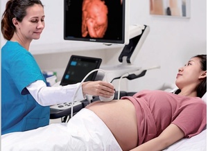 Ecógrafo Humano con Carro, Instrumento de Diagnóstico por Ultrasonido Doppler Color 4D 5D - Product Image 5