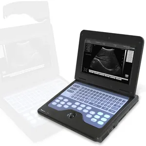 CONTEC-dispositivos ultrasónicos portátiles para hospital, máquina de ultrasonido, instrumentos médicos de ultrasonido, CMS600P2