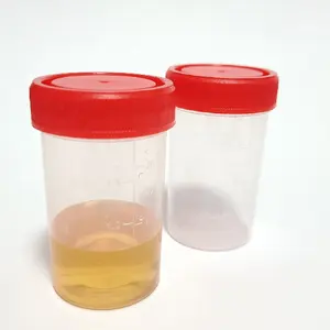 UC-FP10040 40ml nhựa mẫu nước tiểu Bộ sưu tập dùng một lần nhựa Mẫu container nước tiểu container