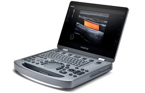 Ecógrafo Veterinario Digital Mindray MX6 con Doppler Color 3D 4D, Precio Competitivo para Uso Veterinario - Product Image 2