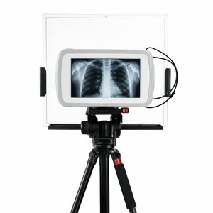 Elde Taşınabilir DR Röntgen 90 Kv Dijital Röntgen Göğüs Röntgeni Yazılımlı ve WIFI özellikli Veteriner Röntgen Cihazı - Product Image 2