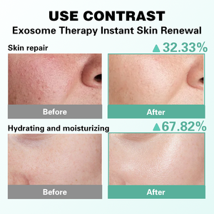 S Offre Spéciale cuivre Peptides visage sérum Boost collagène et renouvellement cellulaire Exoso Glow sérum pour les rides ridules et élasticité de la peau - Product Image 4