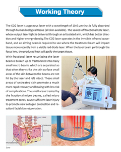 Accesorios de Alta Calidad para Máquina Láser de CO2 Profesional Facial para el Cuidado y Rejuvenecimiento Facial, Láser de CO2 para Mujeres - Product Image 3