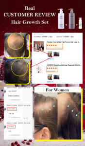 बायोटिन केराटिन के साथ महिलाओं और पुरुषों के लिए पौधे-आधारित बाल विकास स्प्रे, पतले बालों और खोपड़ी की देखभाल के लिए बाल विकास स्प्रे - Product Image 5