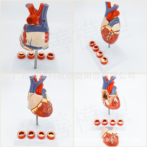 Stent cardiaque, bypass des artères coronaires, chirurgie ouverte de la valve cardiaque, thrombose humaine, démonstration de la structure cardiaque et vasculaire - Product Image 4