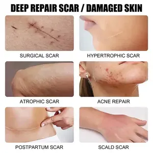 ครีมลบรอยแผลเป็น30กรัมครีมลบรอยแผลเป็น mooyam - Product Image 3